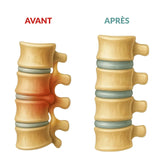 Spineva™ - Triple action massager